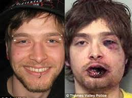 ex-boxeador de 72 anos